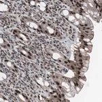 Merck Anti-GTF2F2 antibody produced in rabbit