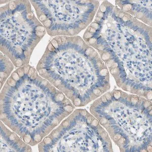 Merck Anti-ATRN antibody produced in rabbit