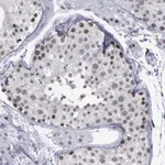Merck Anti-BRD1 antibody produced in rabbit