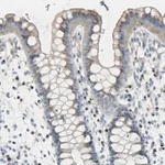 Merck Anti-B4GALT3 antibody produced in rabbit