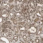 Merck Anti-USP42 antibody produced in rabbit