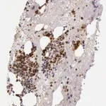 Merck Anti-KDM6A antibody produced in rabbit