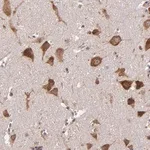Merck Anti-USP51 antibody produced in rabbit
