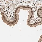 Merck Anti-ZBTB33 antibody produced in rabbit