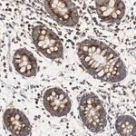 Merck Anti-HSD17B10 antibody produced in rabbit