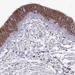 Merck Anti-IGBP1 antibody produced in rabbit