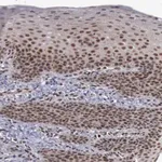 Merck Anti-TRMT2A antibody produced in rabbit