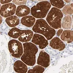 Merck Anti-IFIT2 antibody produced in rabbit