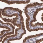 Merck Anti-IGBP1 antibody produced in rabbit