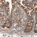 Merck Anti-C1orf43 antibody produced in rabbit