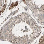 Merck Anti-CFAP61 antibody produced in rabbit