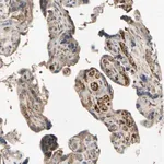 Merck Anti-IL1RL1 antibody produced in rabbit