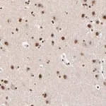 Merck Anti-ZMYM3 antibody produced in rabbit