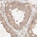 Merck Anti-DEUP1 antibody produced in rabbit