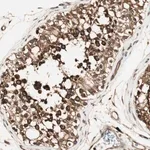Merck Anti-ZNF443 antibody produced in rabbit