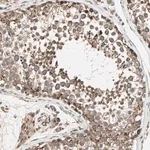 Merck Anti-ZNF37A antibody produced in rabbit