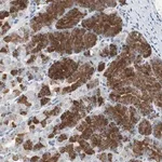 Merck Anti-ADNP2 antibody produced in rabbit
