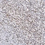 Merck Anti-ZNF74 antibody produced in rabbit