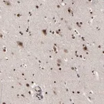Merck Anti-ZNF777 antibody produced in rabbit