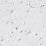 Merck Anti-ZSCAN1 antibody produced in rabbit
