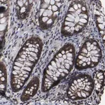 Merck Anti-KIAA2026 antibody produced in rabbit