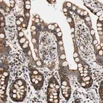 Merck Anti-KIAA0907 antibody produced in rabbit