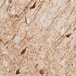 Merck Anti-KLHDC7B antibody produced in rabbit