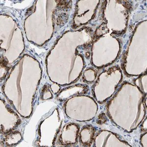 Merck Anti-RETSAT antibody produced in rabbit