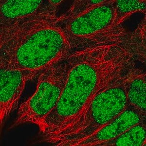 Merck Anti-RBX1 antibody produced in rabbit