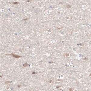 Merck Anti-REPS2 antibody produced in rabbit