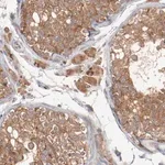 Merck Anti-RNASE11 antibody produced in rabbit