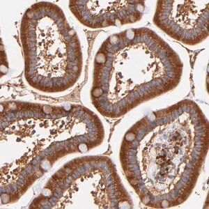 Merck Anti-RPL27 antibody produced in rabbit