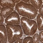 Merck Anti-RPS6KA6 antibody produced in rabbit