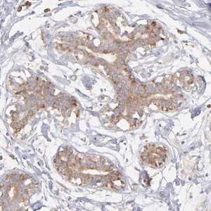 Merck Anti-RPLP0 antibody produced in rabbit