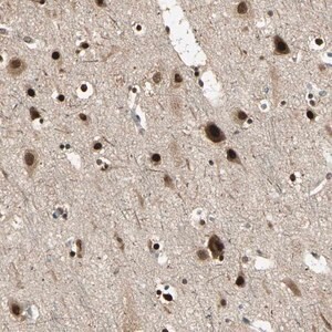 Merck Anti-PSMC3 antibody produced in rabbit