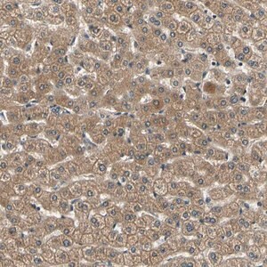 Merck Anti-LPGAT1 antibody produced in rabbit
