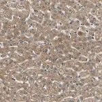 Merck Anti-LPGAT1 antibody produced in rabbit