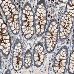 Merck Anti-LMTK2 antibody produced in rabbit