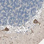 Merck Anti-MAP3K21 antibody produced in rabbit