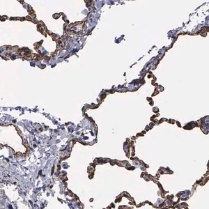 Merck Anti-MAGEB10 antibody produced in rabbit