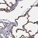 Merck Anti-MAGEB10 antibody produced in rabbit