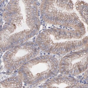 Merck Anti-LRCH2 antibody produced in rabbit