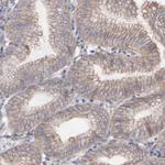 Merck Anti-LRCH2 antibody produced in rabbit