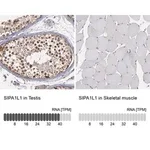 Merck Anti-SIPA1L1 antibody produced in rabbit