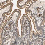Merck Anti-SFXN3 antibody produced in rabbit