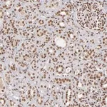 Merck ANTI-ZNF148 antibody produced in rabbit
