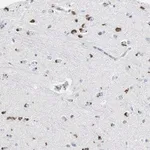 Merck Anti-SERPINF1 antibody produced in rabbit