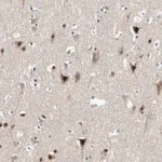 Merck Anti-MARK1 antibody produced in rabbit