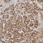 Merck Anti-SLC30A9 antibody produced in rabbit