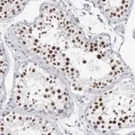 Merck Anti-MNAT1 antibody produced in rabbit